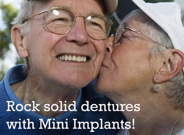 Rock solid dentures with mini implants